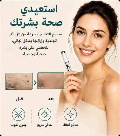 Xorita™ Mole and Wart Instant Removal Laser Pen
