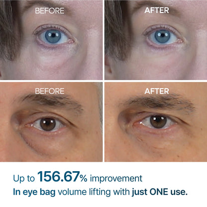 Eyephalt Eyebag Cream