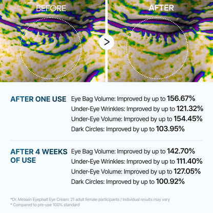 Eyephalt Eyebag Cream