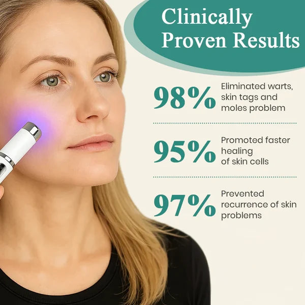 Xorita™ Mole and Wart Instant Removal Laser Pen