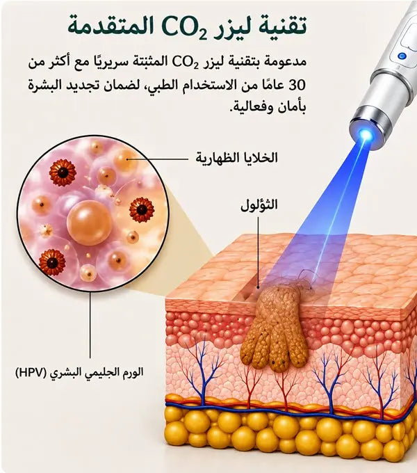 Xorita™ Mole and Wart Instant Removal Laser Pen